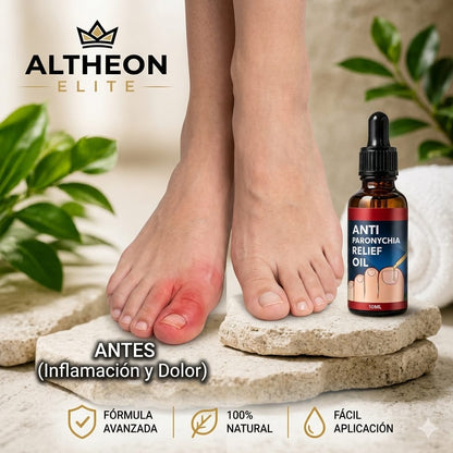 ANTI HONGO TOENAILPLUS